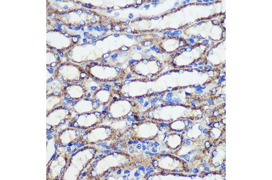 Immunohistochemistry - Anti-SND1 Antibody (A15028) - Antibodies.com
