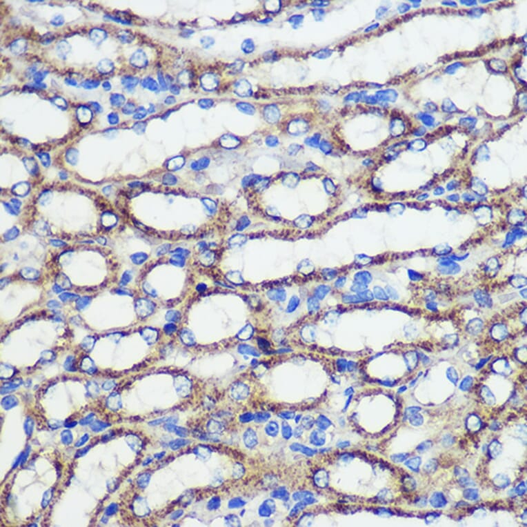 Immunohistochemistry - Anti-SND1 Antibody (A15028) - Antibodies.com