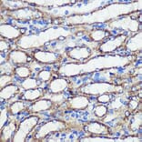 Immunohistochemistry - Anti-SND1 Antibody (A15028) - Antibodies.com