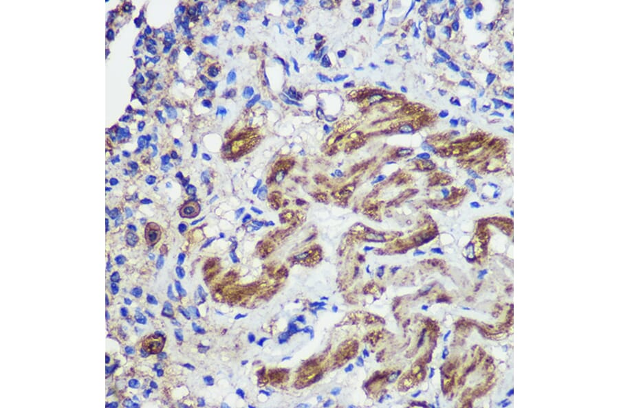 Immunohistochemistry - Anti-SND1 Antibody (A15028) - Antibodies.com