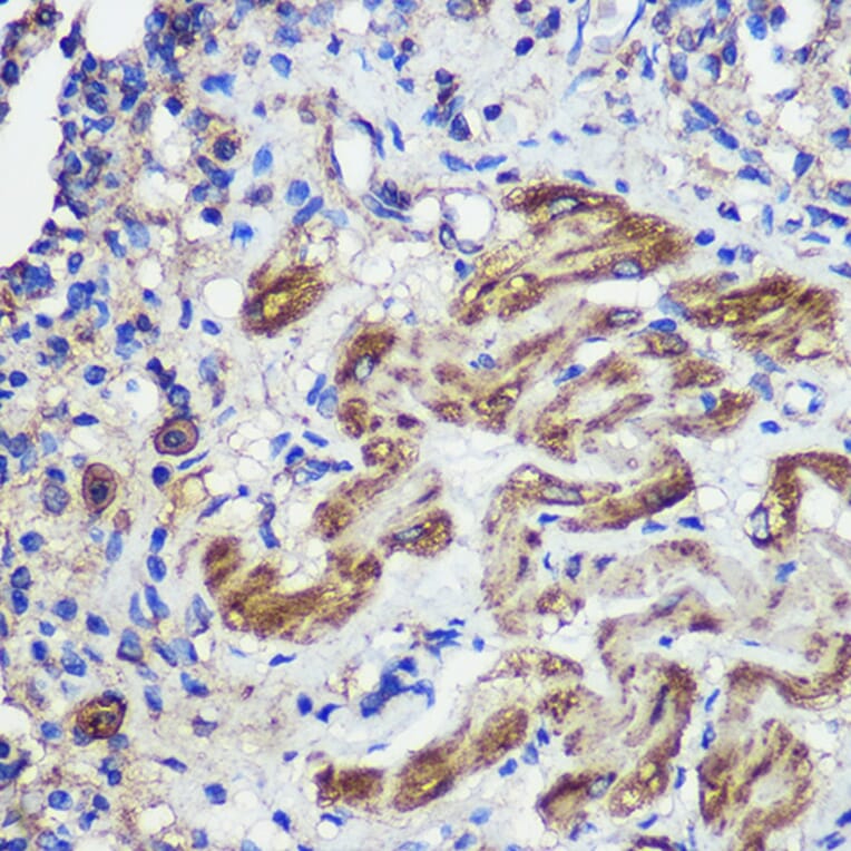 Immunohistochemistry - Anti-SND1 Antibody (A15028) - Antibodies.com