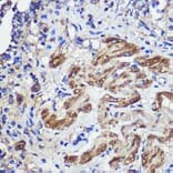 Immunohistochemistry - Anti-SND1 Antibody (A15028) - Antibodies.com