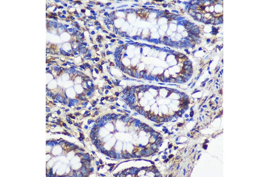 Immunohistochemistry - Anti-SND1 Antibody (A15028) - Antibodies.com