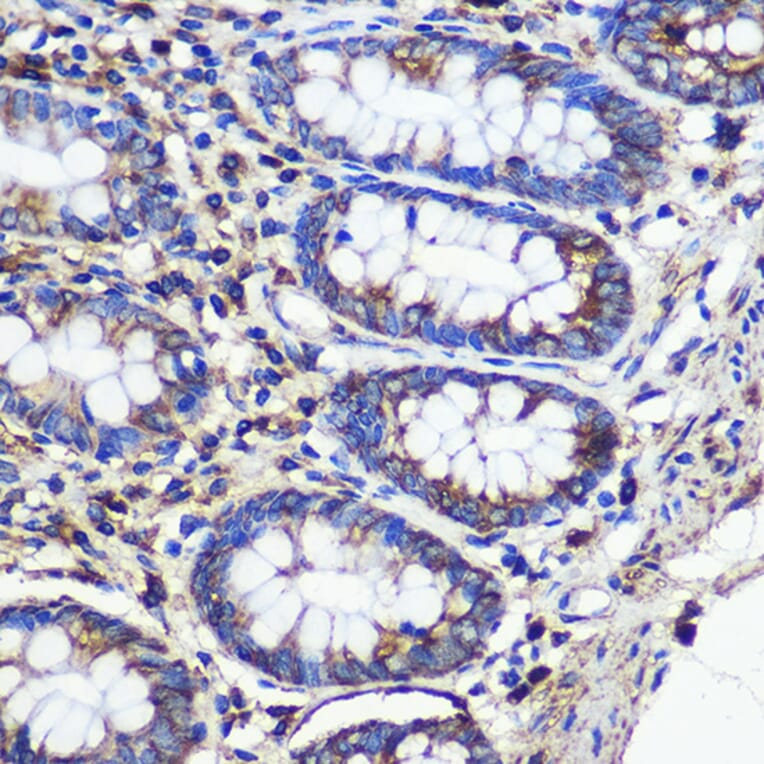 Immunohistochemistry - Anti-SND1 Antibody (A15028) - Antibodies.com
