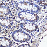 Immunohistochemistry - Anti-SND1 Antibody (A15028) - Antibodies.com
