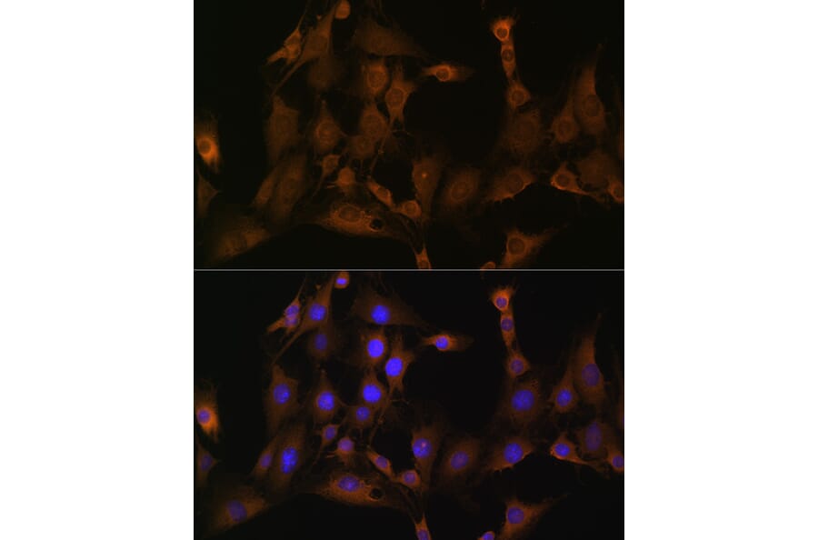 Immunofluorescence - Anti-SND1 Antibody (A15028) - Antibodies.com