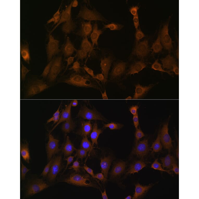 Immunofluorescence - Anti-SND1 Antibody (A15028) - Antibodies.com