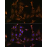 Immunofluorescence - Anti-SND1 Antibody (A15028) - Antibodies.com