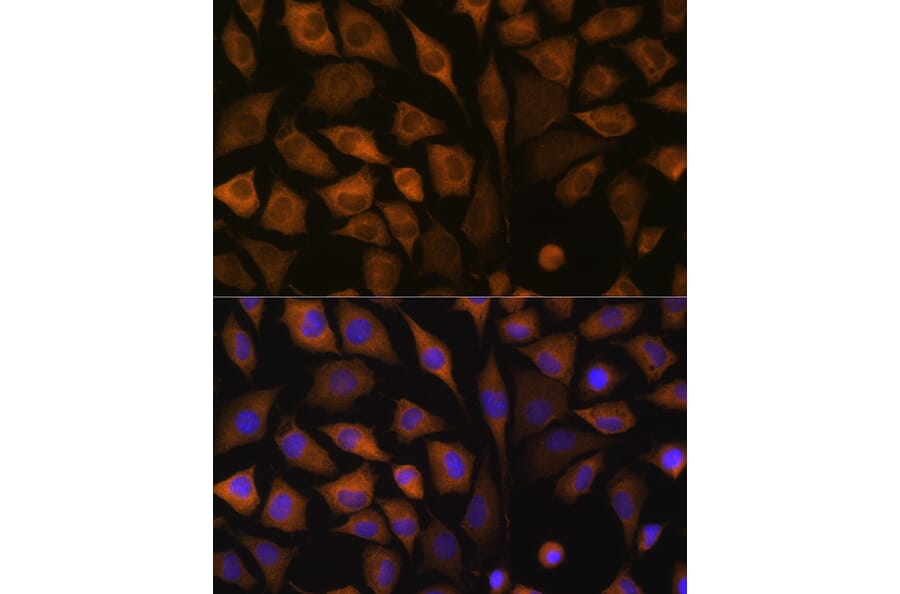 Immunofluorescence - Anti-SND1 Antibody (A15028) - Antibodies.com
