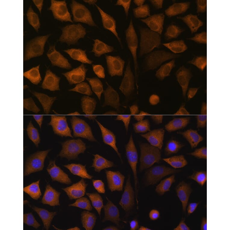 Immunofluorescence - Anti-SND1 Antibody (A15028) - Antibodies.com