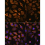 Immunofluorescence - Anti-SND1 Antibody (A15028) - Antibodies.com