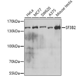 Western Blot - Anti-SF3B2 Antibody (A15029) - Antibodies.com