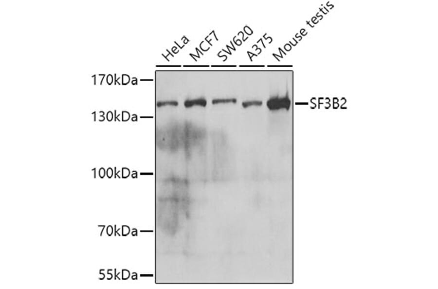 Western Blot - Anti-SF3B2 Antibody (A15029) - Antibodies.com