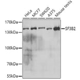 Western Blot - Anti-SF3B2 Antibody (A15029) - Antibodies.com