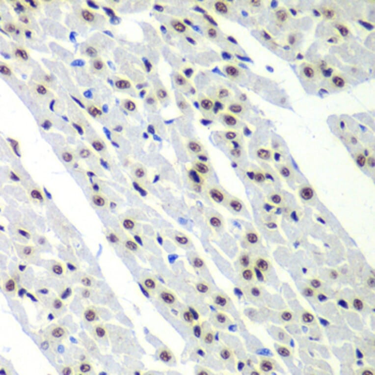 Immunohistochemistry - Anti-SF3B2 Antibody (A15029) - Antibodies.com