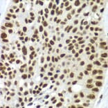Immunohistochemistry - Anti-SF3B2 Antibody (A15029) - Antibodies.com