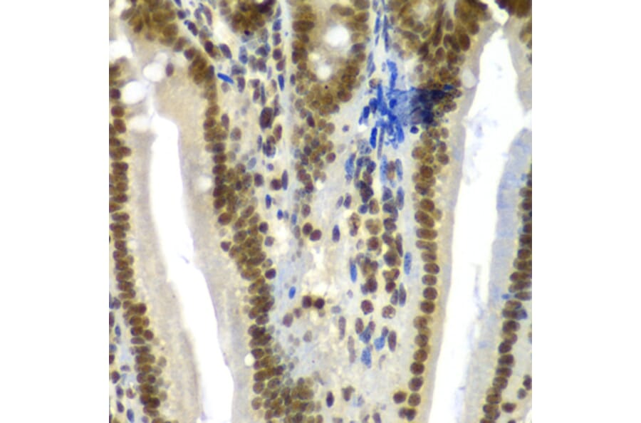 Immunohistochemistry - Anti-SF3B2 Antibody (A15029) - Antibodies.com