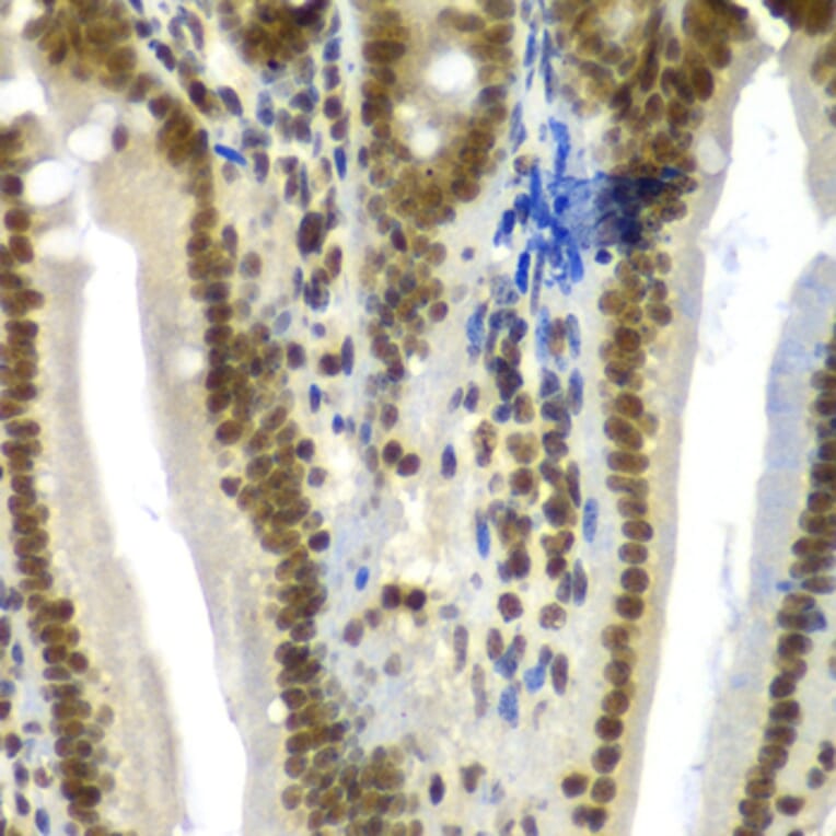 Immunohistochemistry - Anti-SF3B2 Antibody (A15029) - Antibodies.com