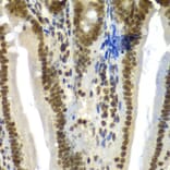 Immunohistochemistry - Anti-SF3B2 Antibody (A15029) - Antibodies.com