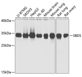 Western Blot - Anti-SBDS Antibody (A15030) - Antibodies.com