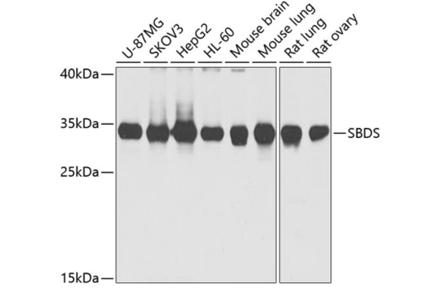 Western Blot - Anti-SBDS Antibody (A15030) - Antibodies.com