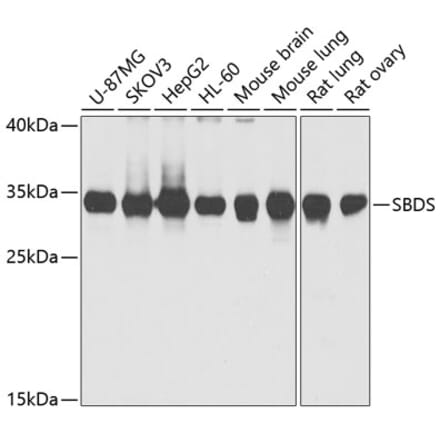 Western Blot - Anti-SBDS Antibody (A15030) - Antibodies.com
