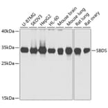 Western Blot - Anti-SBDS Antibody (A15030) - Antibodies.com