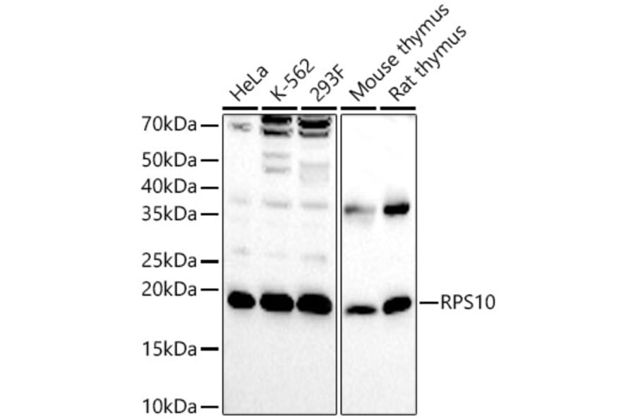 Western Blot - Anti-RPS10 Antibody (A15031) - Antibodies.com