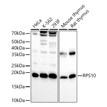 Western Blot - Anti-RPS10 Antibody (A15031) - Antibodies.com