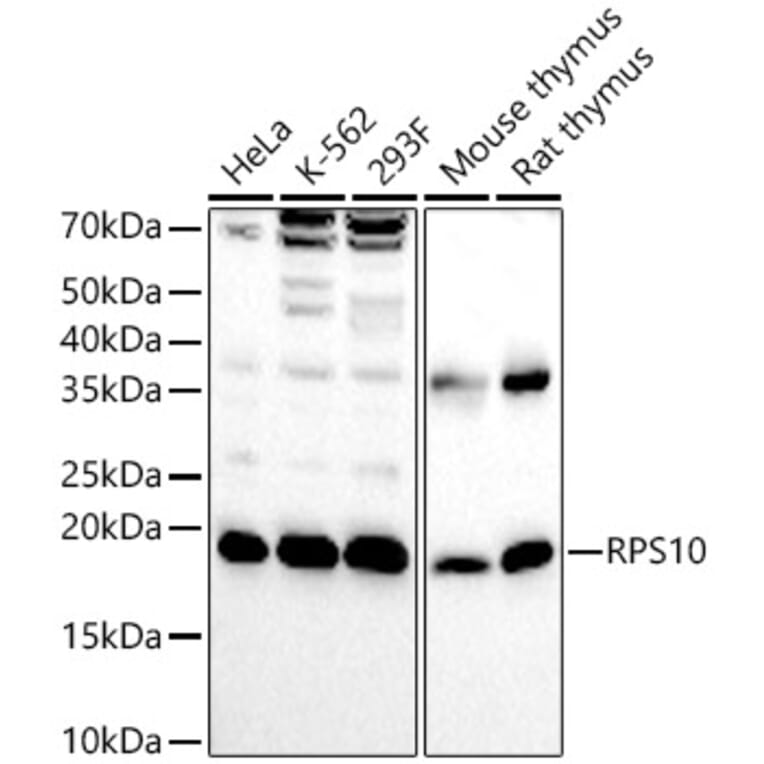 Western Blot - Anti-RPS10 Antibody (A15031) - Antibodies.com