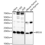 Western Blot - Anti-RPS10 Antibody (A15031) - Antibodies.com