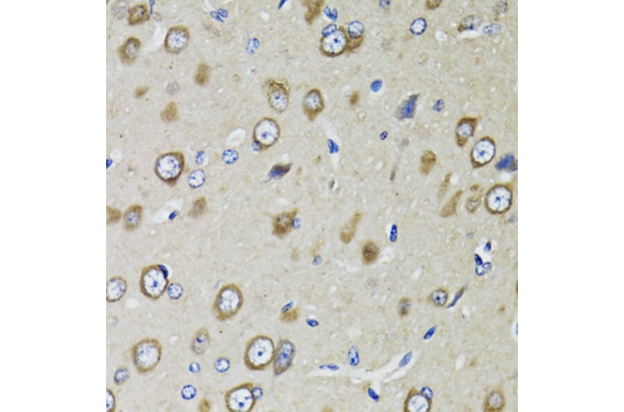 Immunohistochemistry - Anti-RPS10 Antibody (A15031) - Antibodies.com