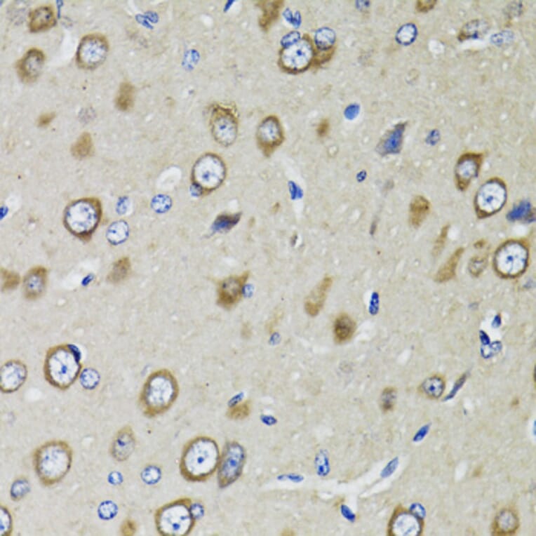 Immunohistochemistry - Anti-RPS10 Antibody (A15031) - Antibodies.com