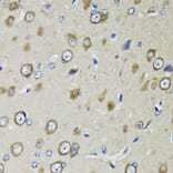 Immunohistochemistry - Anti-RPS10 Antibody (A15031) - Antibodies.com