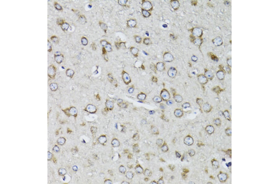 Immunohistochemistry - Anti-RPS10 Antibody (A15031) - Antibodies.com