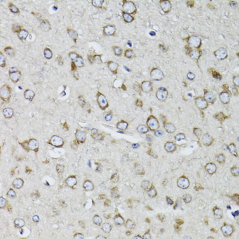 Immunohistochemistry - Anti-RPS10 Antibody (A15031) - Antibodies.com