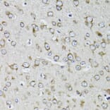 Immunohistochemistry - Anti-RPS10 Antibody (A15031) - Antibodies.com