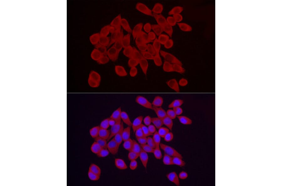 Immunofluorescence - Anti-RPS10 Antibody (A15031) - Antibodies.com