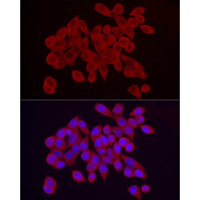 Immunofluorescence - Anti-RPS10 Antibody (A15031) - Antibodies.com