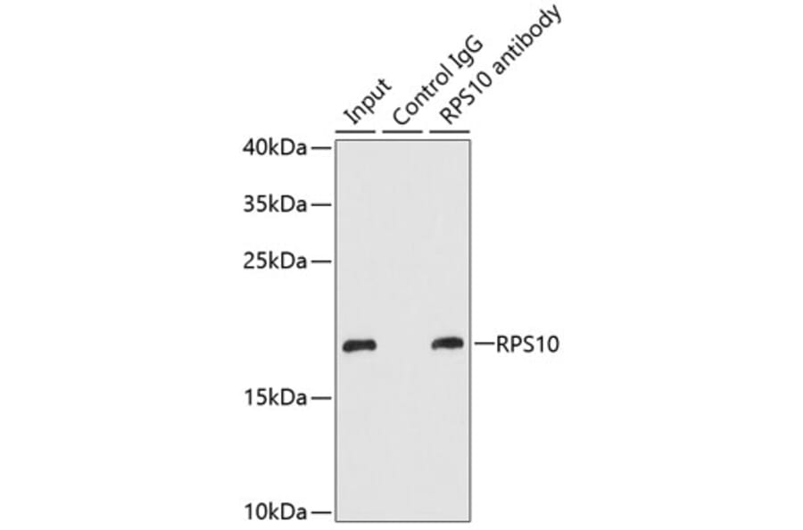 Western Blot - Anti-RPS10 Antibody (A15031) - Antibodies.com