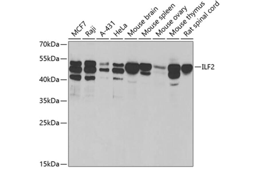 Western Blot - Anti-ILF2/NF45 Antibody (A15032) - Antibodies.com