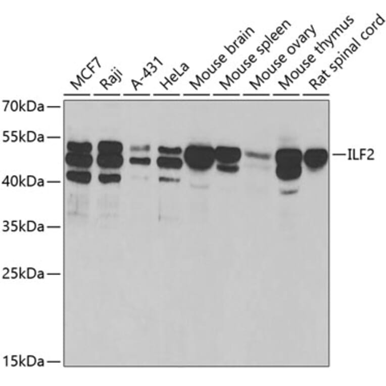 Western Blot - Anti-ILF2/NF45 Antibody (A15032) - Antibodies.com