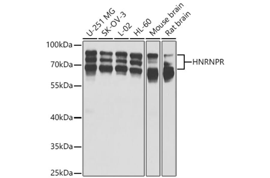 Western Blot - Anti-hnRNP R Antibody (A15033) - Antibodies.com