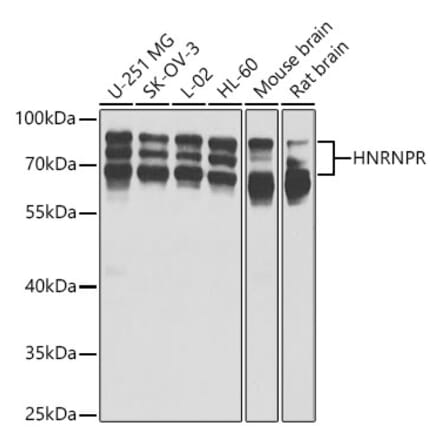 Western Blot - Anti-hnRNP R Antibody (A15033) - Antibodies.com