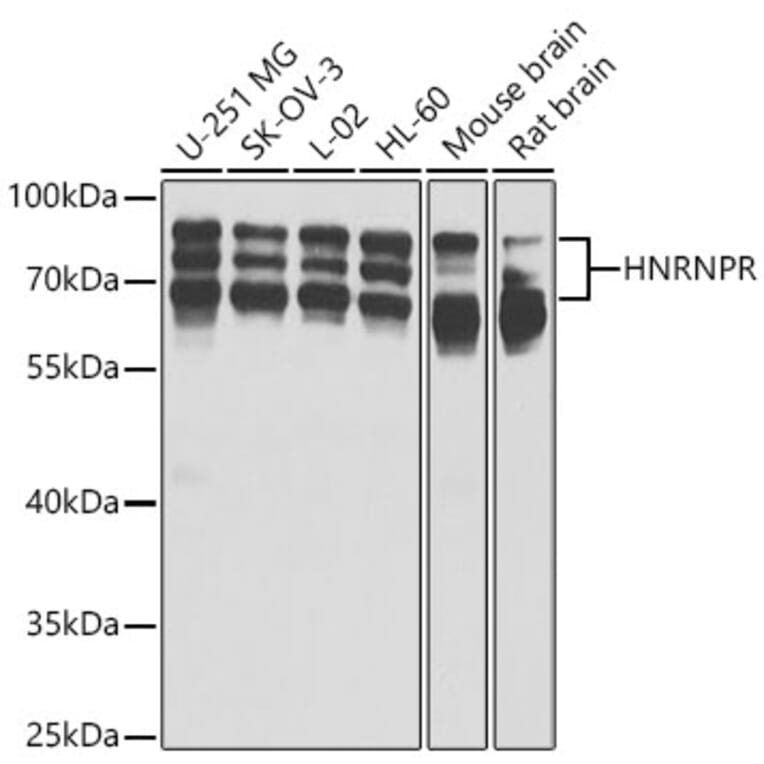 Western Blot - Anti-hnRNP R Antibody (A15033) - Antibodies.com