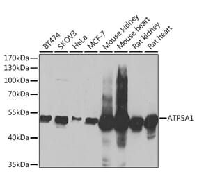 Western Blot - Anti-ATP5A Antibody (A15034) - Antibodies.com