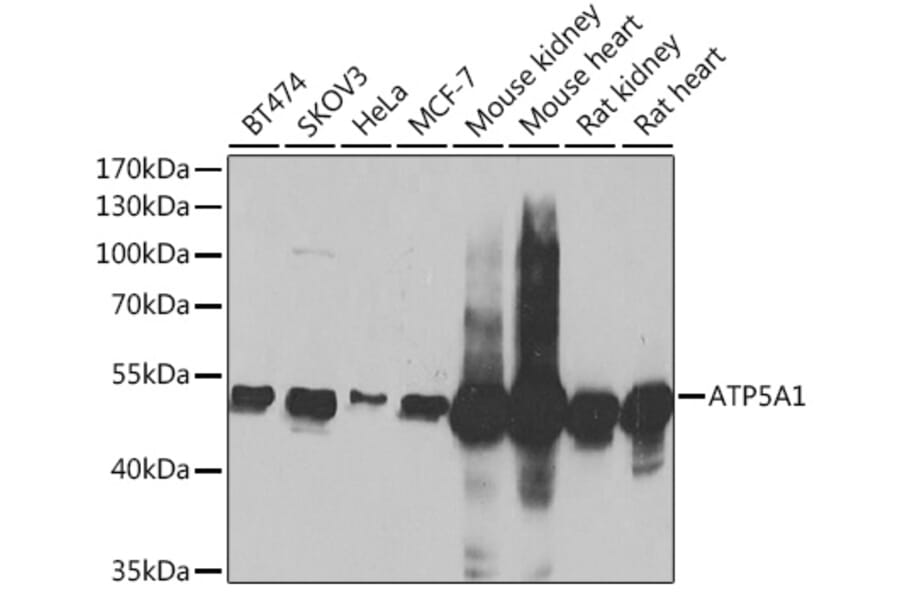 Western Blot - Anti-ATP5A Antibody (A15034) - Antibodies.com