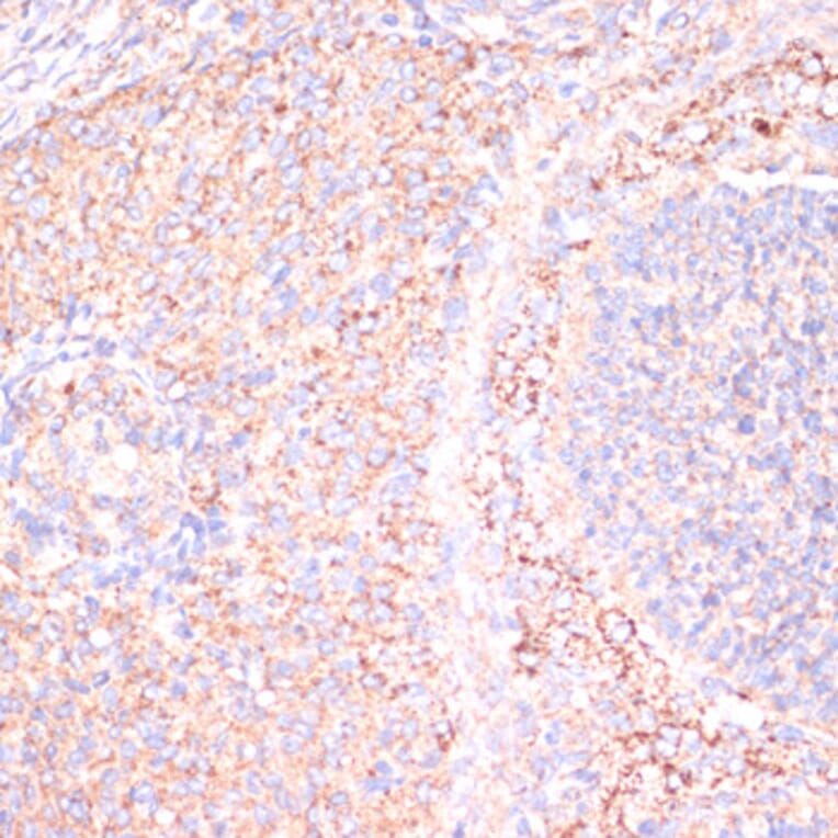 Immunohistochemistry - Anti-ATP5A Antibody (A15034) - Antibodies.com