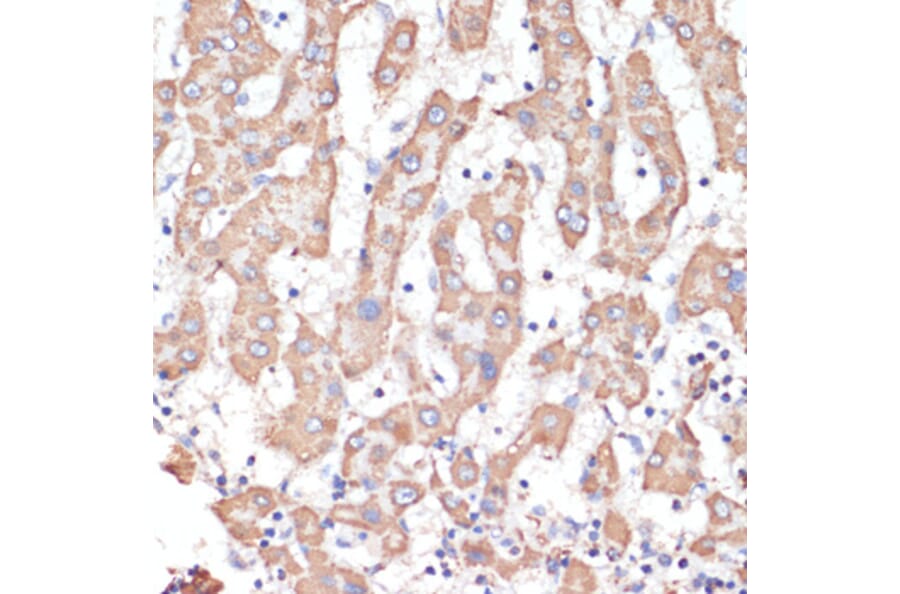Immunohistochemistry - Anti-ATP5A Antibody (A15034) - Antibodies.com