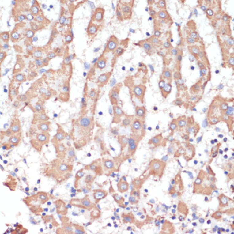 Immunohistochemistry - Anti-ATP5A Antibody (A15034) - Antibodies.com